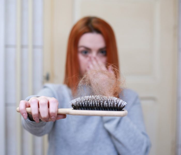 hair loss
